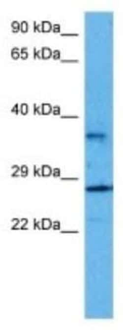 Cytochrome b reductase 1 Rabbit anti-Human, Polyclonal, Novus Biologicals:Antibodies:Primary